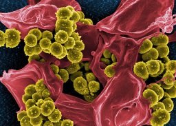 Estafilococos - Bactéria que cresce na piscina sem deseinfecção